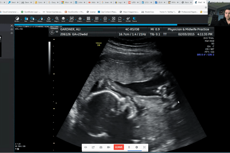 A clinician reviewing an ultrasound study within a TeleRay imaging session