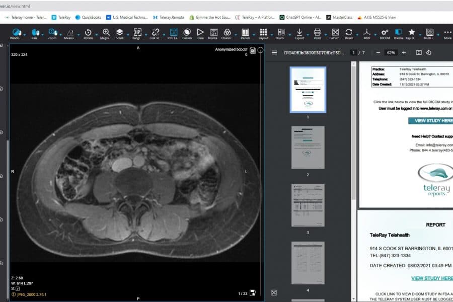 TeleRay's DICOM viewer showing an MRI study with linked reports for secure exchange